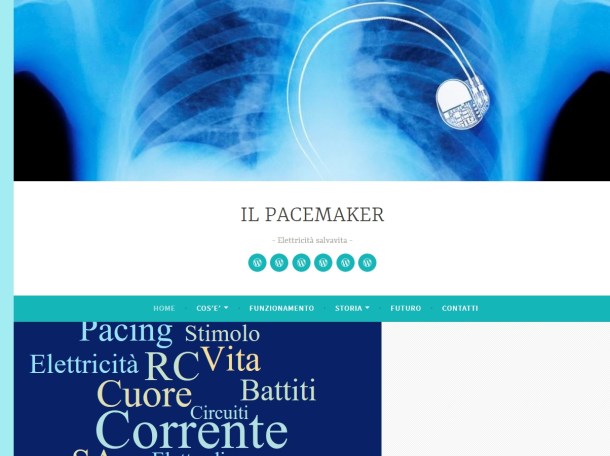 pacemaker